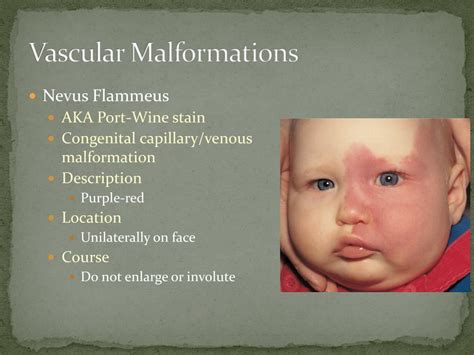 PPT - Hemangiomas and Vascular Malformations PowerPoint Presentation, free download - ID:780098