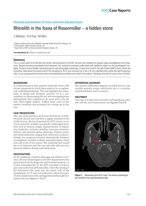 (PDF) Rhinolith in the fossa of Rosenmüller - A hidden stone