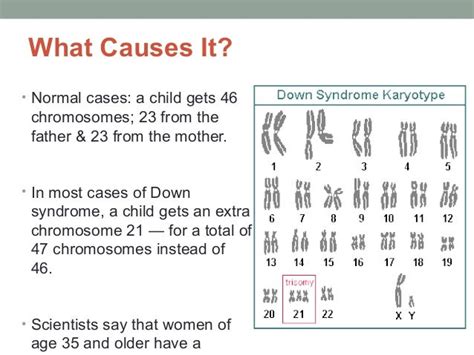 Down syndrome