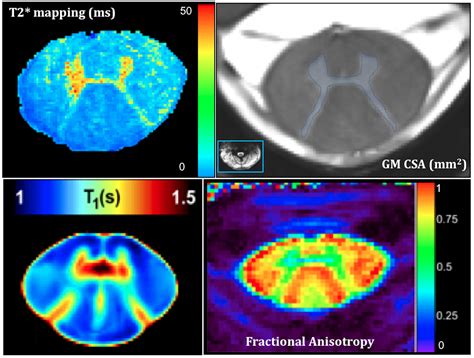 SC#2 - Quantitative and UHF SC MRI - Center for Magnetic Resonance in Biology and Medicine