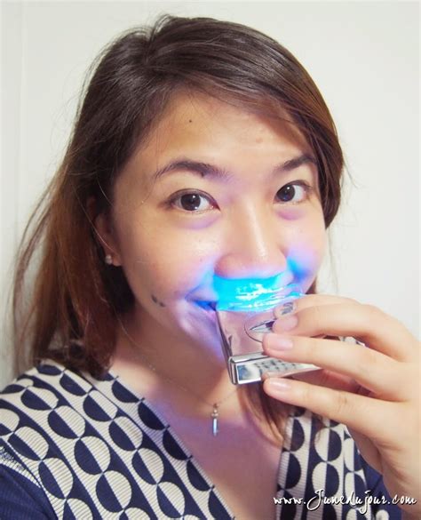 Review: Smile Brilliant Professional LED Teeth Whitening kit | JuneduJour / Singapore Fashion ...