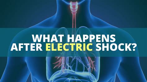 What Happens After Electric Shock: Here's What To Know