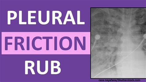 Pleural Friction Rub Lung (Breath) Sounds Abnormal - YouTube