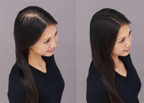 Why Is My Hair Thinning at the Part? - Toppik Blog