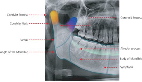 Face | Radiology Key