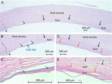 Histological light microscopy images 54 months after Descemet membrane ...