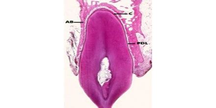 Periodontal Fiber - Assignment Point