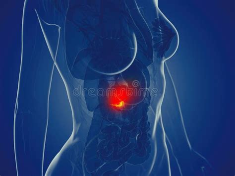 A womans pancreas stock illustration. Illustration of greenish - 149550925