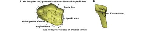 Scaphoid And Lunate Fossa