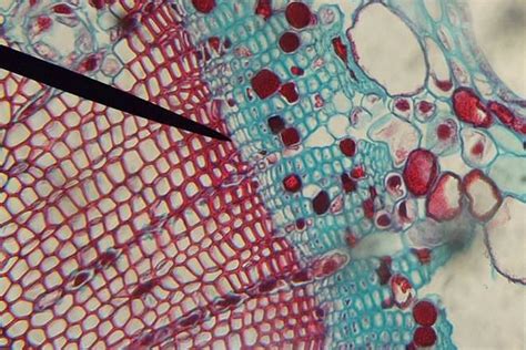 Phloem vs Xylem - Difference and Comparison | Diffen