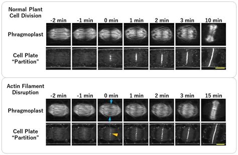 Actin filaments control the shape of the cell structure that divides plant cells