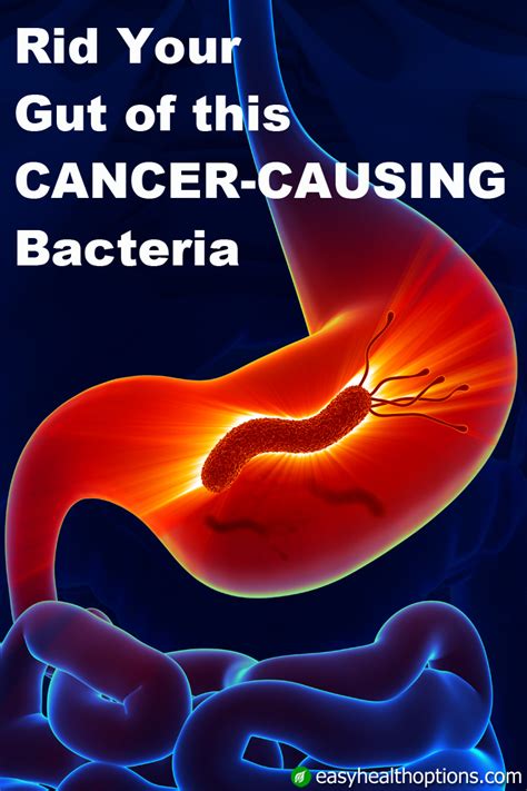 Rid your gut of this cancer-causing bacteria - Easy Health Options®