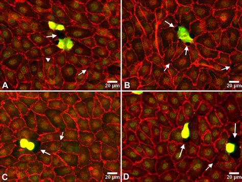 Vascular endothelial (VE)-cadherin staining (red) for cell-cell... | Download Scientific Diagram