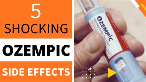 5 SHOCKING OZEMPIC SIDE EFFECTS - YouTube