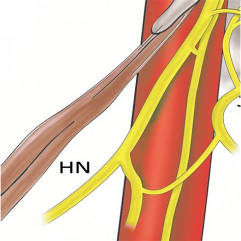 Nerves of the right jugular foramen and their relationships | Download Scientific Diagram