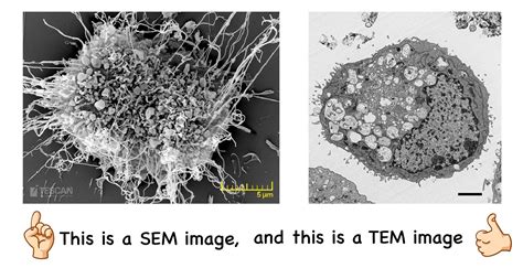 5 Science Facts Behind Astonishing Electron Microscope Images - Rs' Science