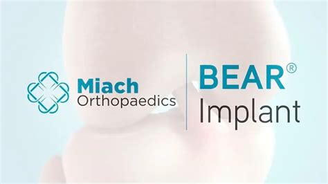 NFLPA Joins $40M Investment Round of Miach Orthopaedics - Profluence