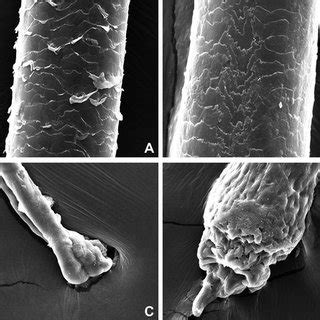 Scanning Electron Microscopy images of the hairs. Hair shaft of a... | Download Scientific Diagram