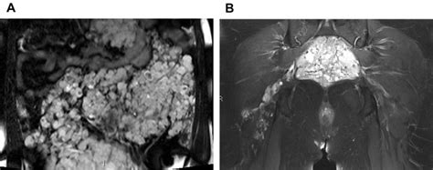 Imaging of Vascular Malformations | Radiology Key