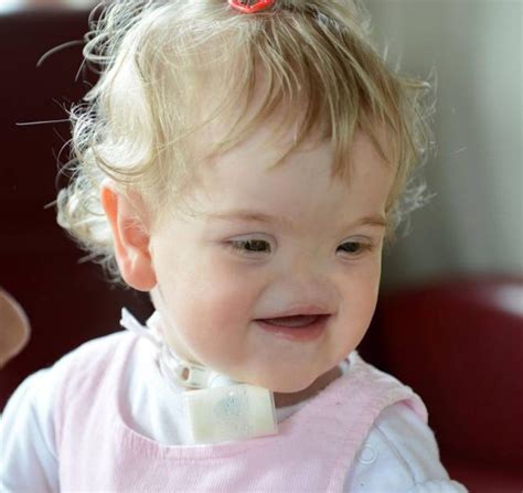 Tessa Evans: The girl born with no nose who always has a smile | Metro News