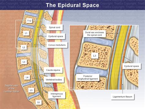 The Epidural Space - TrialQuest Inc.