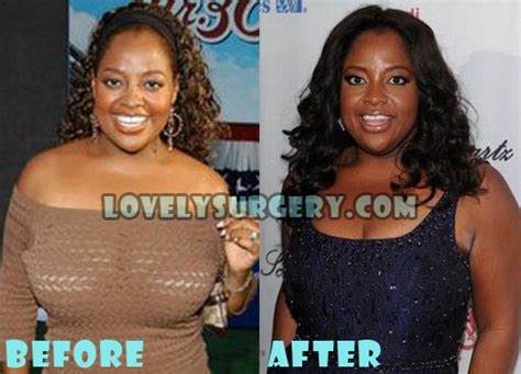 Sherri Shepherd Plastic Surgery Breast Reduction - Lovely Surgery