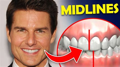 Total 42+ imagen tom cruise teeth - fr.thptnganamst.edu.vn