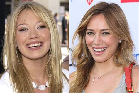 Celebrities Gone Dental: Before And After Photos Of Toothy Transformations | HuffPost