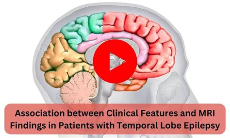 Association between Clinical Features and MRI Findings in Patients with ...