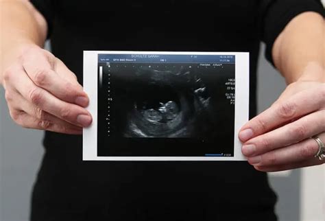 Sonogram vs Ultrasound: A More In-Depth Distinction Between The Two