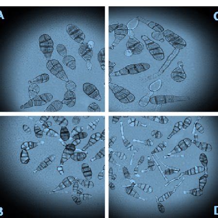 Germination of two isolates of Alternaria alternata spores. A: treated... | Download Scientific ...