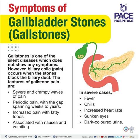 Gallstones, Gallbladder Stones – Symptoms, Causes, Complications