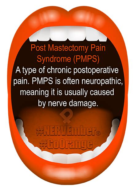 What is Post Mastectomy Pain Syndrome - iPain Foundation Condtions