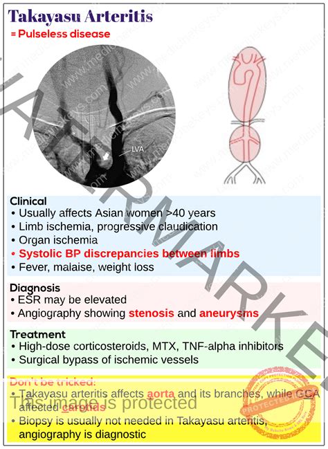 Takayasu arteritis - Medicine Keys for MRCPs