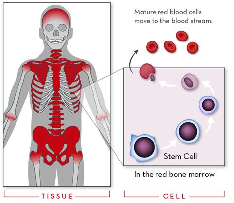 Hemoglobin Disorders