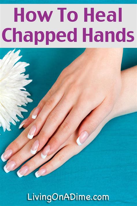 How To Heal Chapped Hands - Natural Recipe For Winter Dry Skin - Living on a Dime To Grow Rich