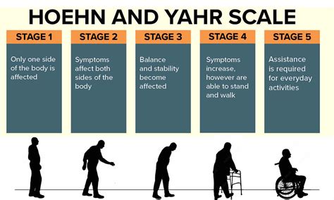 The Five Stages of Parkinson's Disease - Physio Ed.