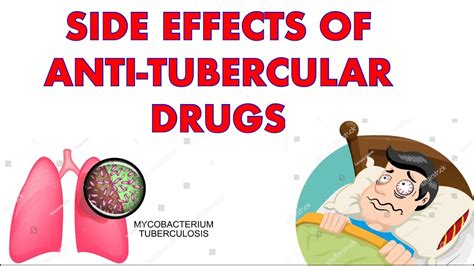 Side effects of Anti Tubercular drugs | RIPE - YouTube