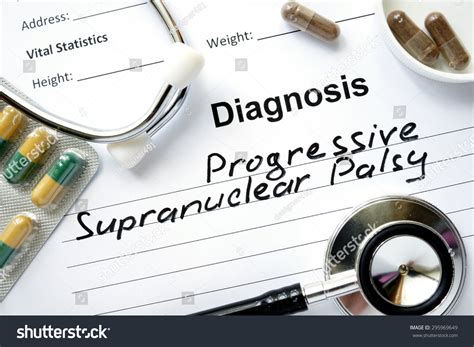 21 Progressive supranuclear palsy Images, Stock Photos & Vectors | Shutterstock