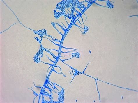 Fun With Microbiology (What's Buggin' You?): Acremonium species