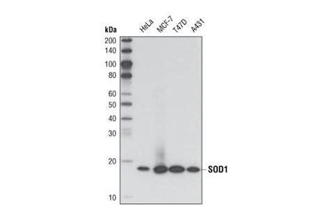 Mitochondrial Marker Antibody Sampler Kit | Cell Signaling Technology