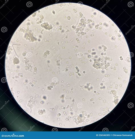 Moderate Bacteria and White Blood Cells in Urine Stock Image - Image of health, clinical: 256546305