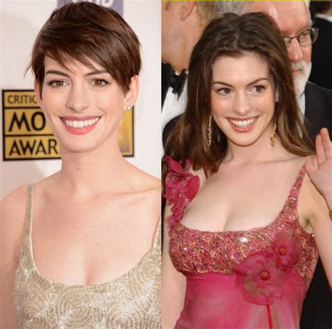 Anne Hathaway Nose Job Before And After Photos