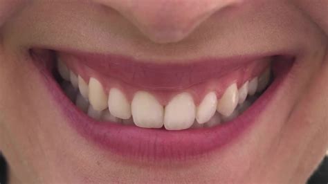 Woman With Beautiful Teeth Smiling - Stock Video | Motion Array