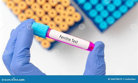 Ferritin Test Result with Blood Sample in Test Tube on Doctor Hand in ...