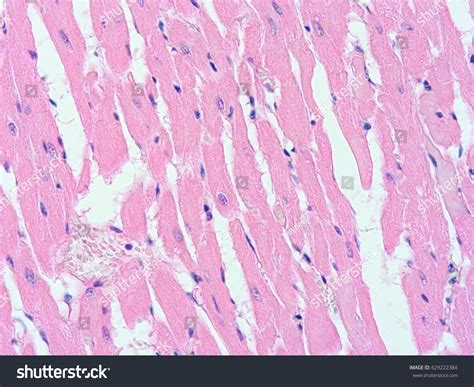 Histology Human Heart Show Cardiac Tissue Stock Photo 629222384 ...