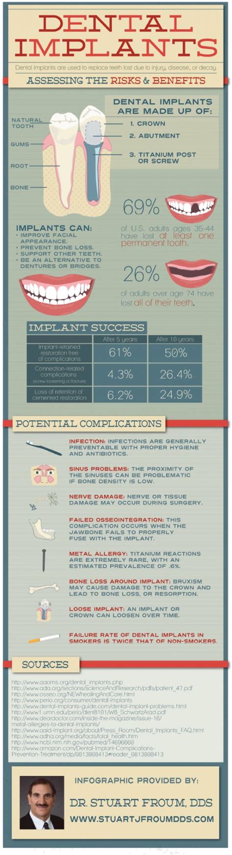 Dental Implants: Assessing the Risks & Benefits Infographic | Medical ...