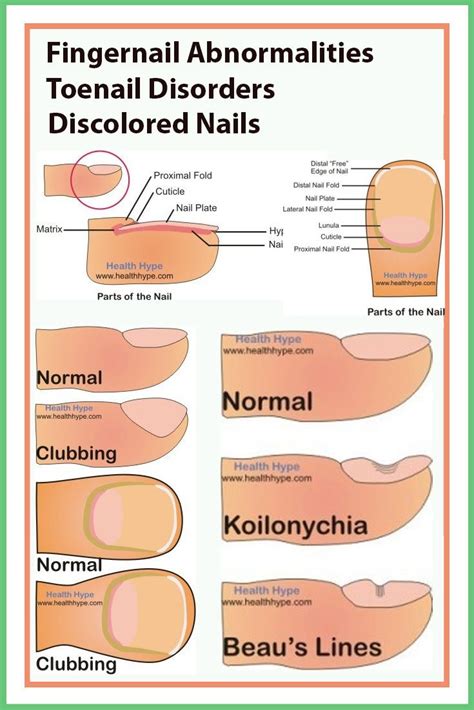 Fingernail Abnormalities, Toenail Disorders, Discolored Nails | Toe ...