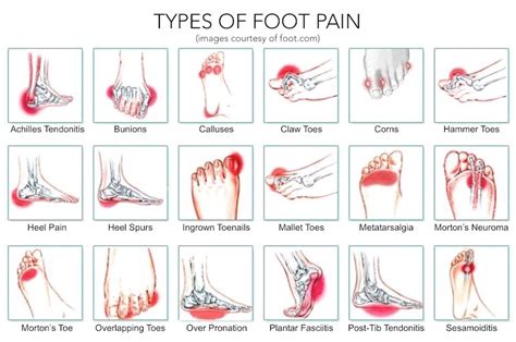 Why Does My Foot Keep Aching at Sonia Mccord blog