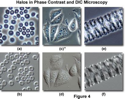 Differential Interference Contrast - Comparison of Phase Contrast and DIC Microscopy | Olympus LS